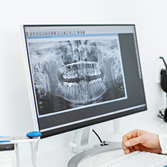 Frankford Dental Group | Oral Cancer Screening, Implant Dentistry and Pediatric Dentistry