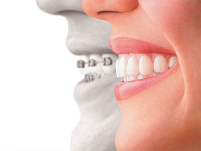 Frankford Dental Group | Extractions, Dental X-Rays and All-on-4 reg