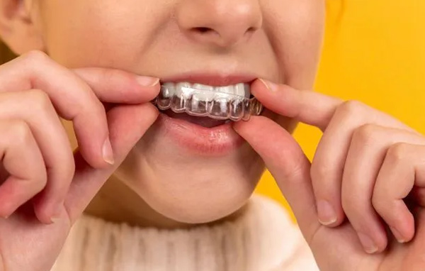 Frankford Dental Group | Family Dental Care, Oral Exams and Invisalign reg 