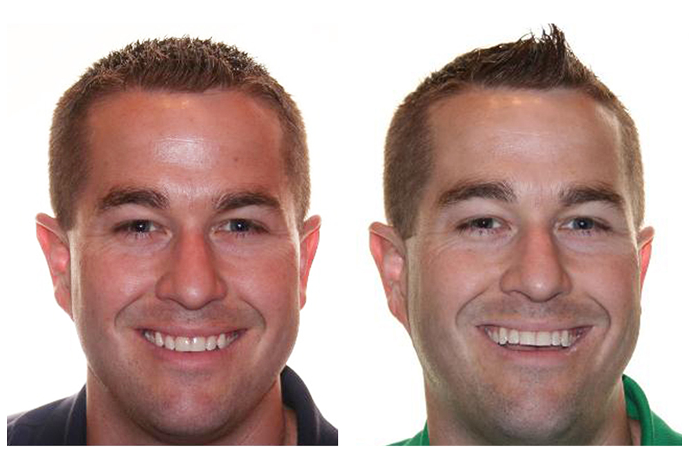 Frankford Dental Group