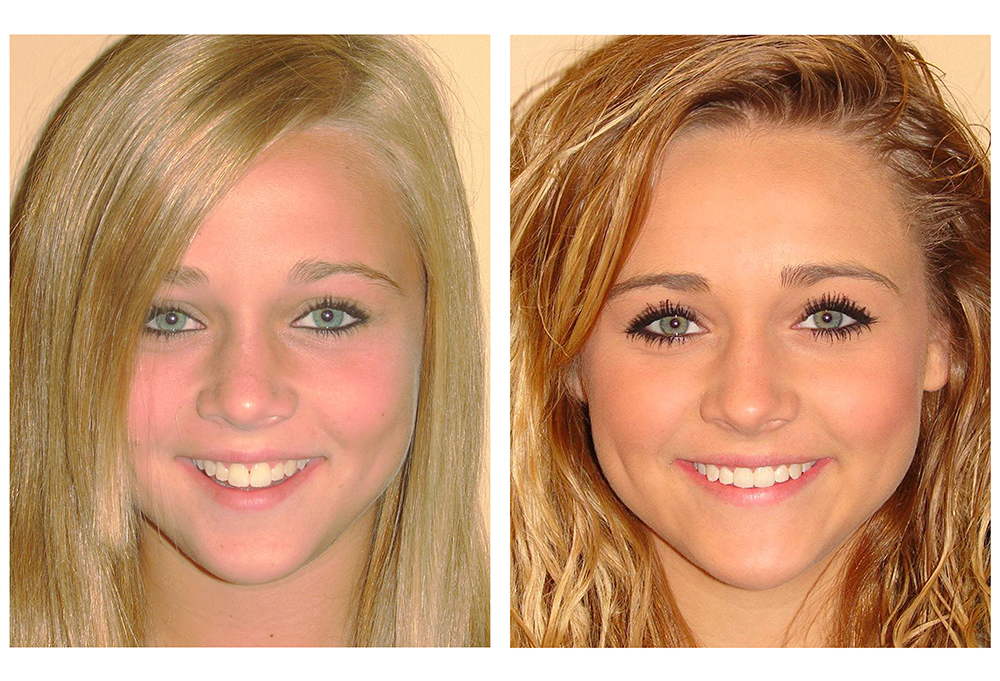 Frankford Dental Group