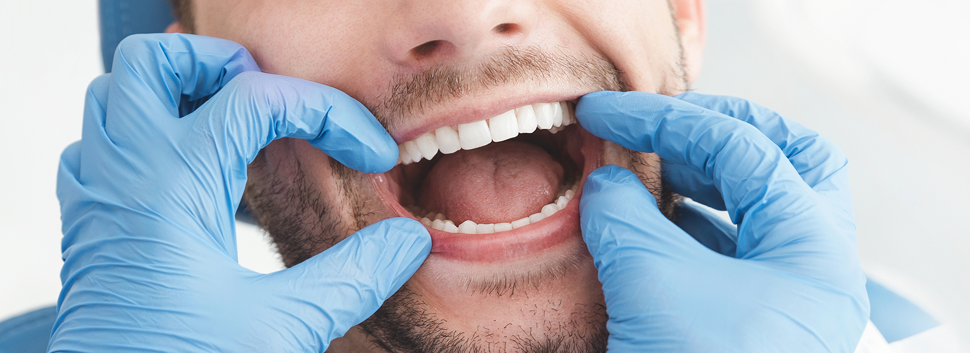 Frankford Dental Group | Oral Exams, Family Dental Care and Fluoride Treatment