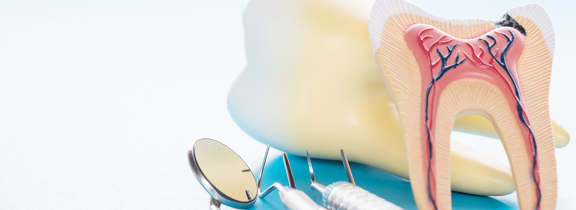 Frankford Dental Group | Pediatric Dentistry, Fluoride Treatment and Oral Exams