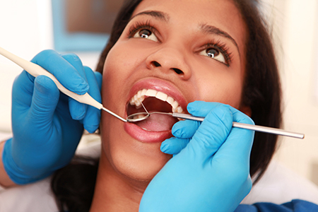 Frankford Dental Group | Preventative Program, All-on-4 reg  and Dental Cleanings